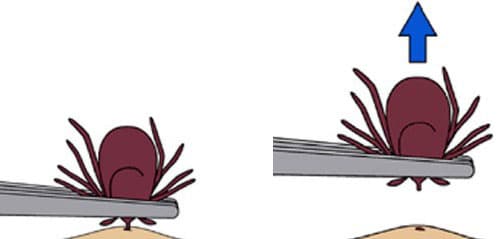 how-to-safely-remove-ticks-in-baltimore